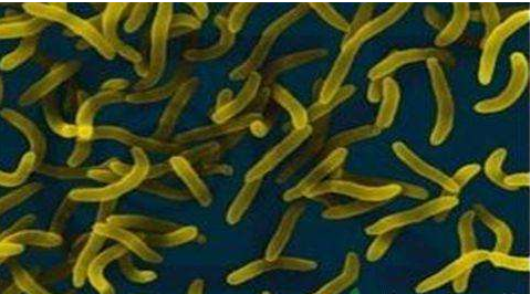 微生物菌劑好？好在哪里您知道嗎？